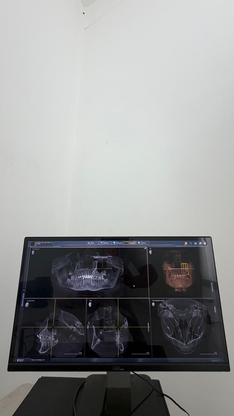 Tomógrafo Sirona Galileos — vista 3